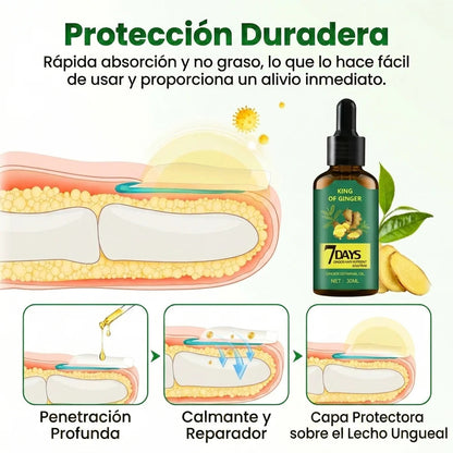 Tratamiento Anti Hongos - en Uñas Amarillas y las Fortalece desde 7 Días